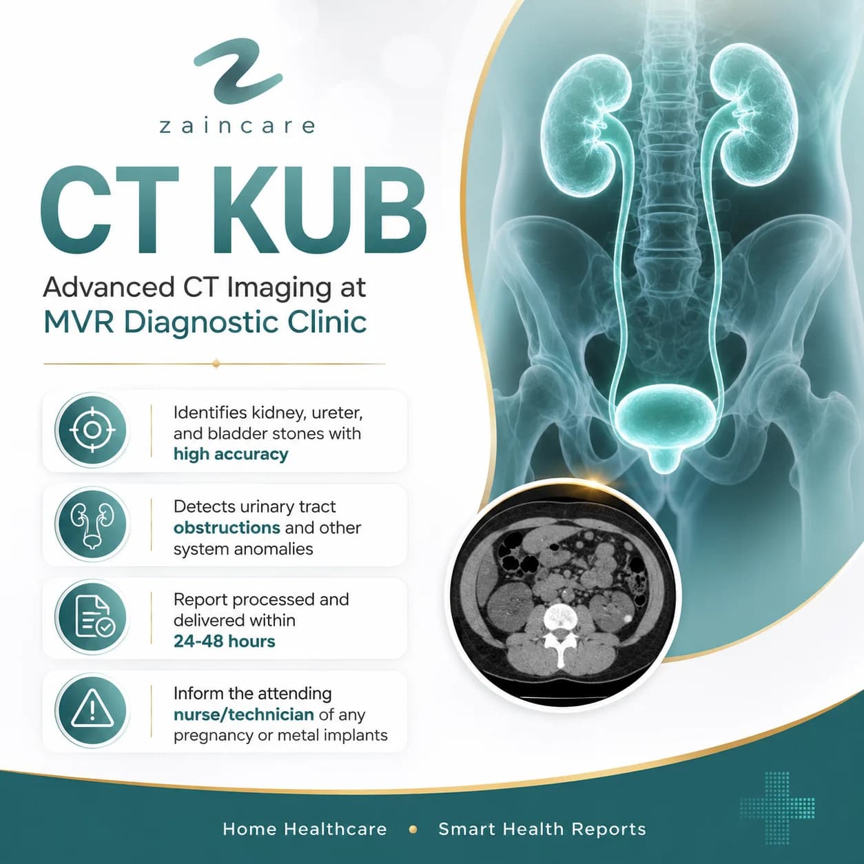CT KUB