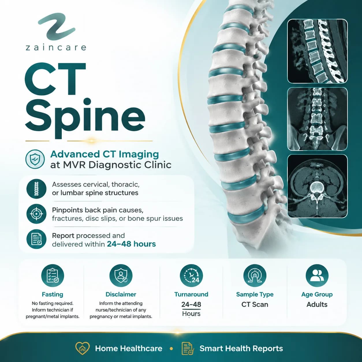CT Spine