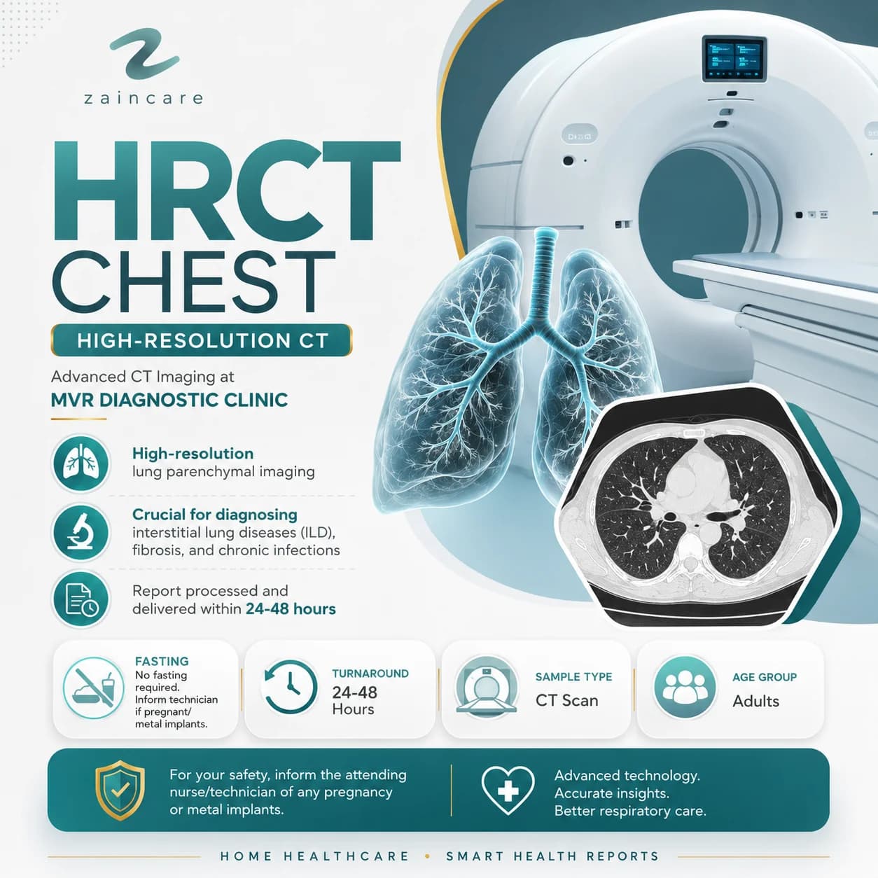 HRCT Chest (High-Resolution CT)